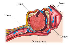 airway是什么意思