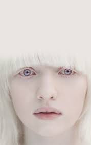 albinism是什么意思
