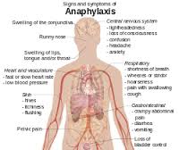anaphylactic是什么意思