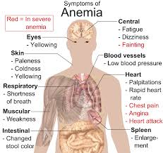 anemia是什么意思