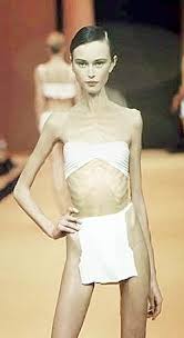 anorexic是什么意思