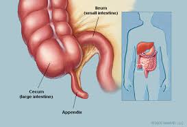 appendix是什么意思