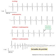 arrhythmic是什么意思