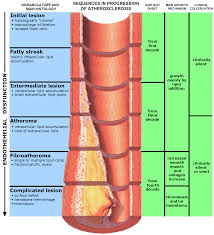 atherosclerosis是什么意思