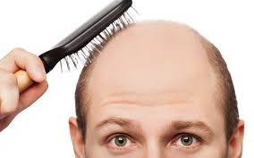 baldness是什么意思