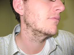 beardless是什么意思
