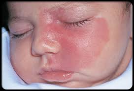birthmark是什么意思