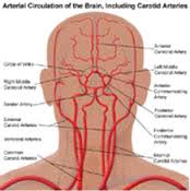carotid是什么意思