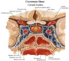 cavernous是什么意思