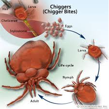 chigger是什么意思