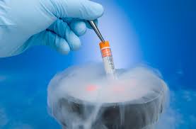 cryogenic是什么意思