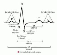 electrocardiogram是什么意思