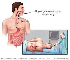 endoscopy是什么意思
