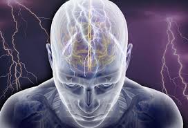 epilepsy是什么意思