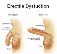 erectile是什么意思