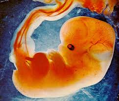 fetus是什么意思