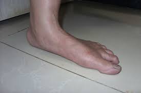 flat-footed是什么意思