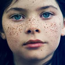 freckled是什么意思