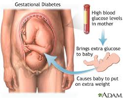 gestational是什么意思