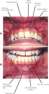 gingival是什么意思