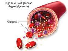 glycemia是什么意思