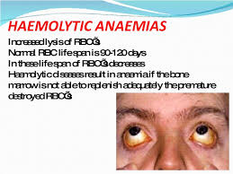 haemolytic是什么意思
