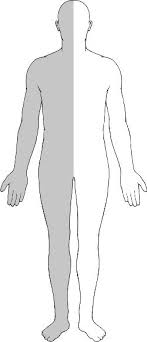 hemiplegia是什么意思