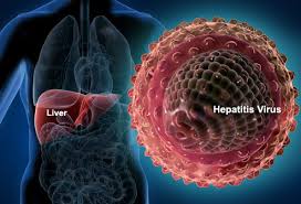 hepatitis是什么意思