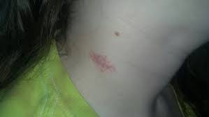 hickey是什么意思