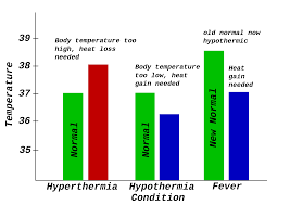 hyperthermia是什么意思