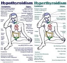 hyperthyroidism是什么意思