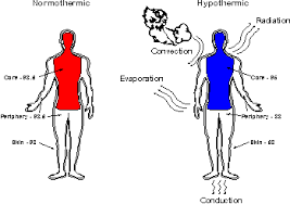 hypothermia是什么意思