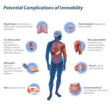 immobility是什么意思