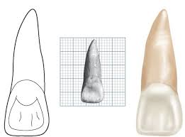 incisor是什么意思