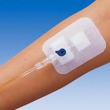 intravenous是什么意思