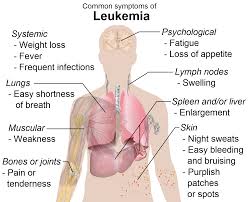 leukemia是什么意思