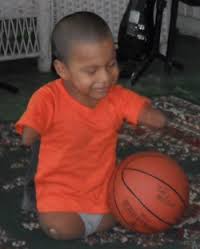 limbless是什么意思