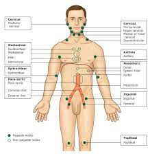 lymphadenopathy是什么意思