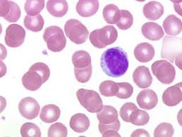 lymphocyte是什么意思