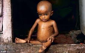 malnourished是什么意思