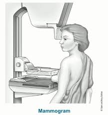 mammogram是什么意思