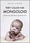 Mongoloid是什么意思