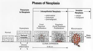 neoplastic是什么意思
