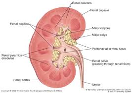 nephrolithiasis是什么意思