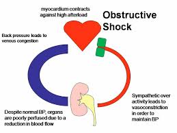 obstructive是什么意思