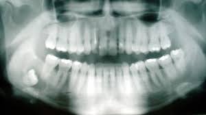 odontology是什么意思