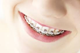 orthodontia是什么意思