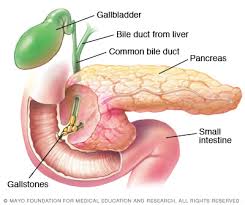 pancreatitis是什么意思
