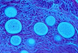 pathogenic是什么意思