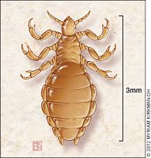 pediculosis是什么意思